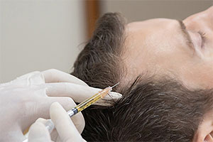 头发再生美容-2