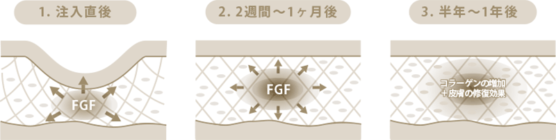 纤维芽细胞疗法