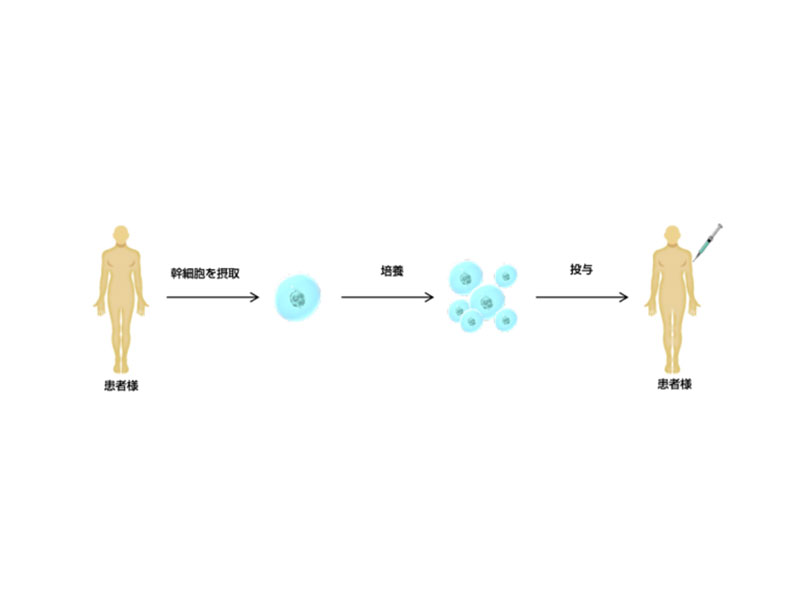 动脉硬化干细胞疗法-4