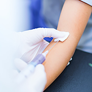 动脉硬化干细胞疗法3