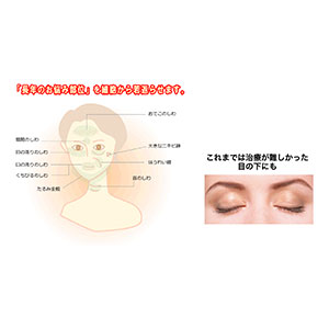 面部多血小板血浆疗法-1