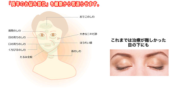 面部多血小板血浆疗法-2