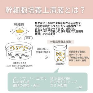 面部干细胞培养上清液-1